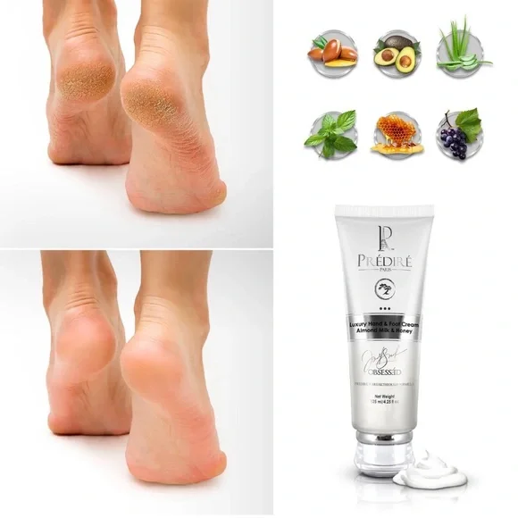 Intensive Foot & Hand Cream for Dry Skin & Rough Skin (Rich with Vitamin E) - Picture 2 of 4